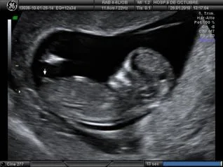 2012 06 25 IMG 2012 06 25 11 10 28 eco semana 12