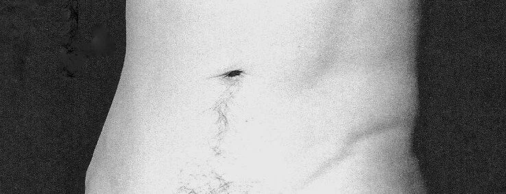 Arte y disidencia, crudeza y belleza: “Hermaphrodite Torso”