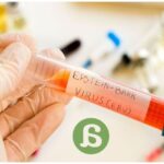 El virus de Epstein-Barr, un avance hacia el conocimiento de la esclerosis múltiple
